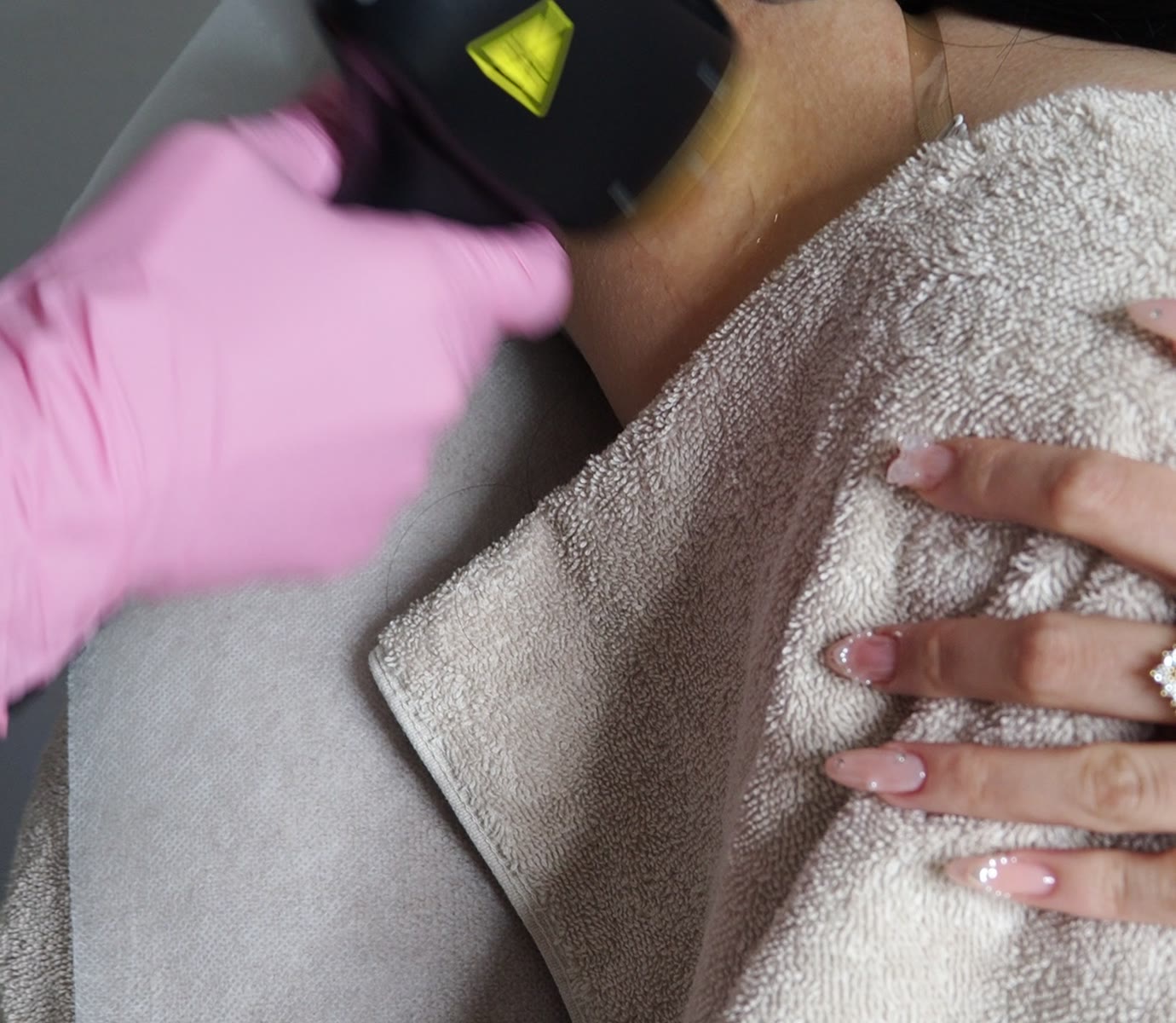 Laserbehandling pågår